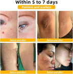 Zidella Skin Lighting Blemish Cream 50g (Pack of 2)